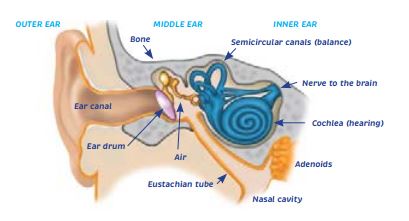 Glue Ear, Middle Ear Infections and Grommets