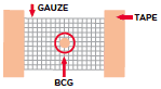BCG Vaccine: After Care for Parents – English version - HE2226 – HealthEd